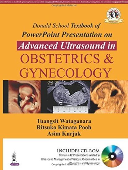 Donald School Textbook of Powerpoint Presentation on Advanced Ultrasound in Obstetrics & Gynecology