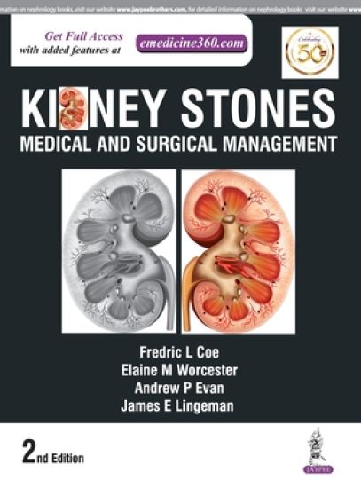 Kidney Stones