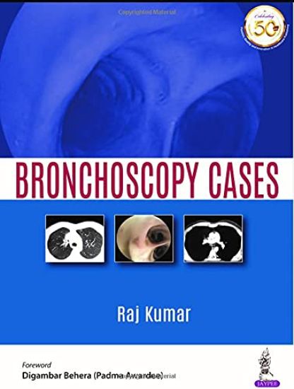 Bronchoscopy Cases