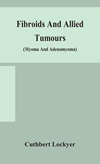 Fibroids and allied tumours (myoma and adenomyoma)