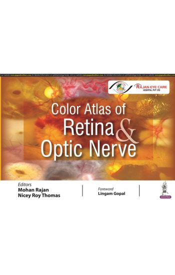Color Atlas of RetinaOptic Nerve