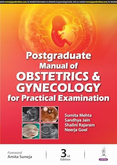 Postgraduate Manual of Obstetrics and Gynecology for Practical Examination