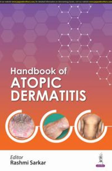 Handbook of Atopic Dermatitis