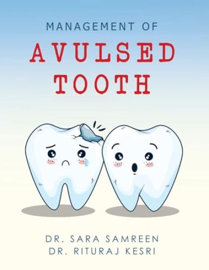 Management of Avulsed tooth