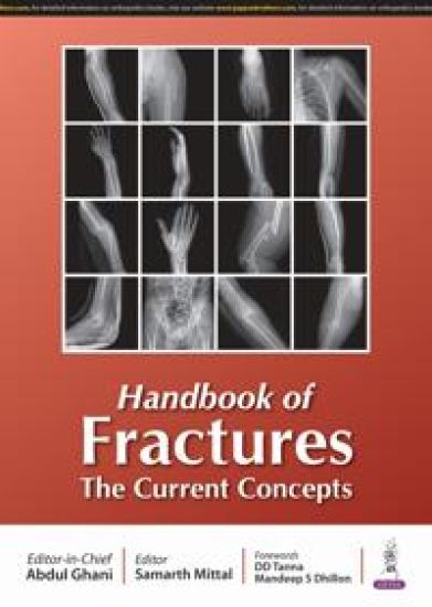 Handbook of Fractures