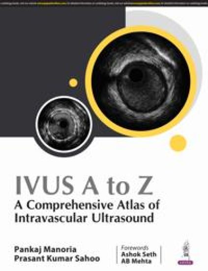 IVUS A to Z