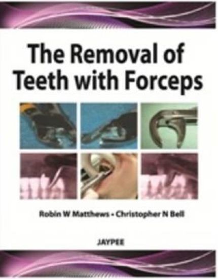 The Removal of Teeth with Forceps