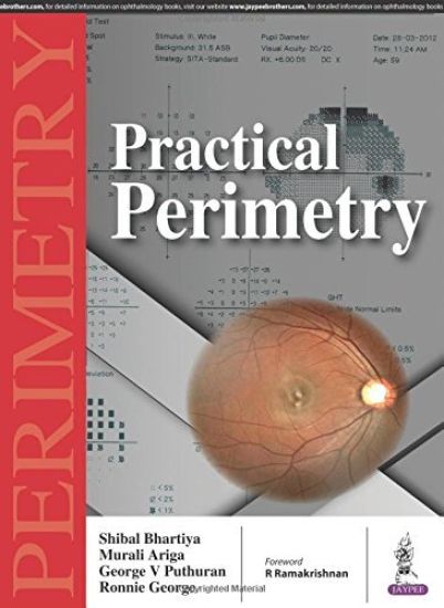 Practical Perimetry