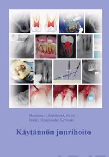 Käytännön juurihoito