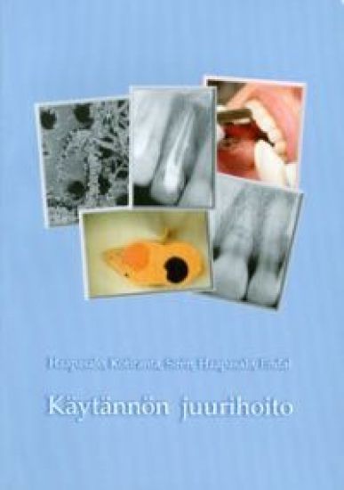 Käytännön juurihoito