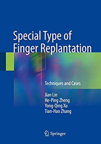 Special Type of Finger Replantation