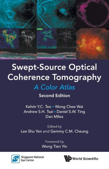 Swept-source Optical Coherence Tomography: A Color Atlas