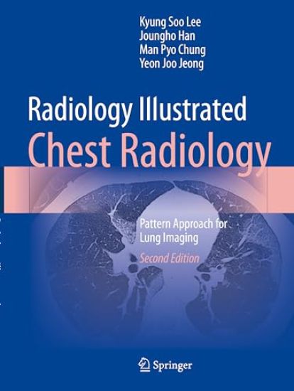 Radiology Illustrated: Chest Radiology