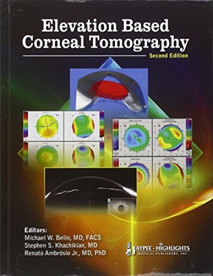 Elevation Based Corneal Tomography