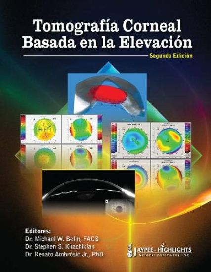 Tomografía Corneal Basada en la Elevación