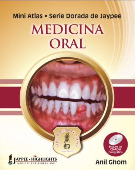 Mini Atlas Serie Dorada de Jaypee: Medicina Oral