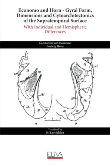 Economo and Horn - Gyral Form, Dimensions and Cytoarchitectonics of the Supratemporal Surface