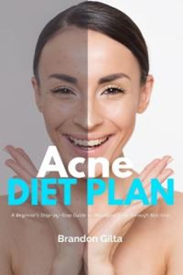 Acne Diet Plan